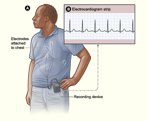 Holter EKG | Kardiolog - Lekarz Andrzej Rosiński